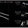 Figure 49